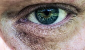 Castor Oil and Eye Comfort: What You Really Need to Know