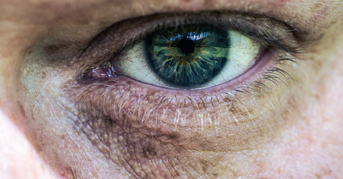 Castor Oil and Eye Comfort: What You Really Need to Know