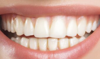 Eggshell Powder for Teeth: Natural Support for a Whiter, Stronger Smile