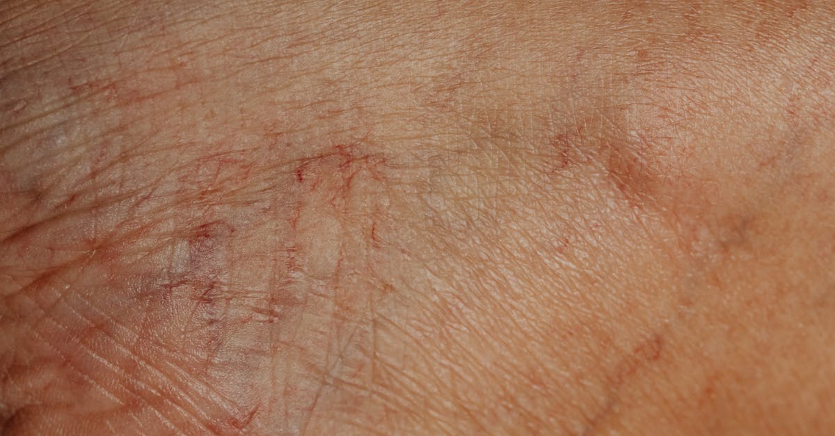 White Spots on the Skin After Age 50: 8 Hidden Causes to Watch For